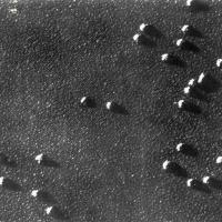 Ribosomi isolati del bacillo del colera con ingrandimento di 230.000 diametri,  maggio - giugno 1962, anno X, n. 3, p. 64